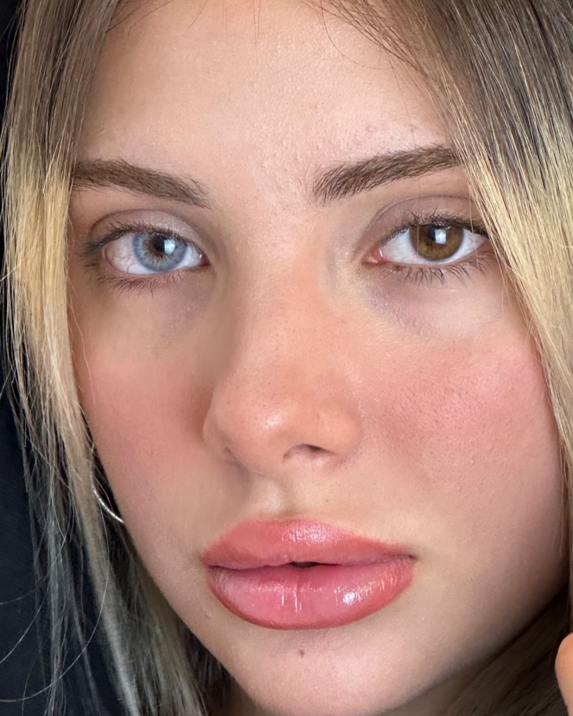 Explore Matia Premium Blue Monthly Colored Contacts for dark eyes. Create a fresh blue eye look with 60% water content and powers from 0.00 to -8.00.